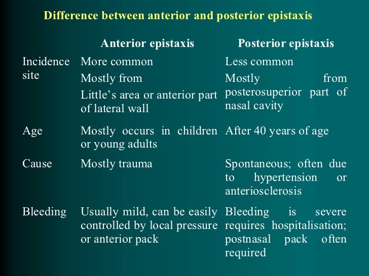 Epistaxis Epistaxis
