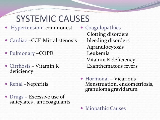 Epistaxis Epistaxis