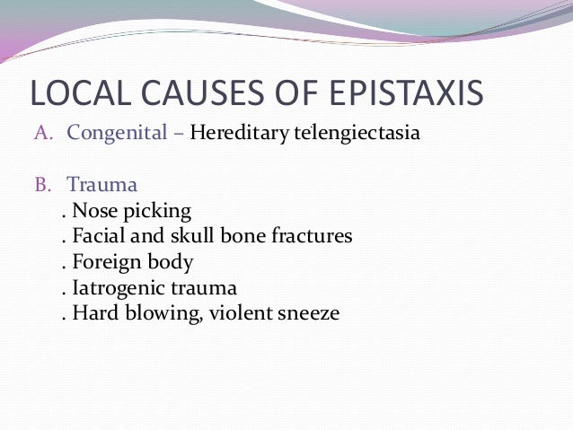 Epistaxis Epistaxis