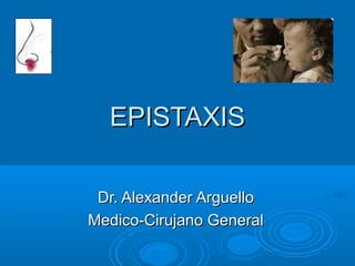 EPISTAXISEPISTAXIS
Dr. Alexander ArguelloDr. Alexander Arguello
Medico-Cirujano GeneralMedico-Cirujano General
 