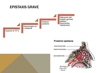EPISTAXIS GRAVE
Supone el 10 %
Hemorragia uni
o bilateral
Anterior/
posterior
Alteración del
estado general,
palidez,
taquicardia,
hipotensión
 