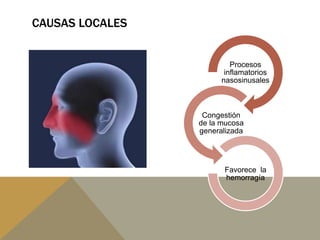 CAUSAS LOCALES
Procesos
inflamatorios
nasosinusales
Congestión
de la mucosa
generalizada
Favorece la
hemorragía
 