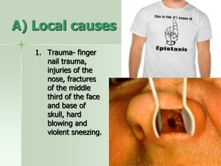 A) Local causes
1. Trauma- finger
nail trauma,
injuries of the
nose, fractures
of the middle
third of the face
and base of
skull, hard
blowing and
violent sneezing.
 