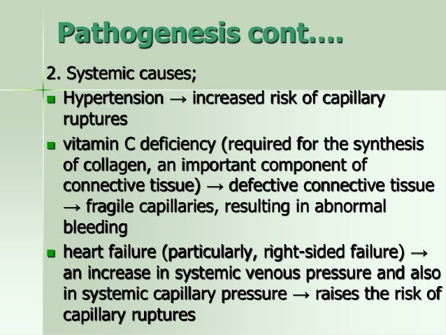 Epistaxis