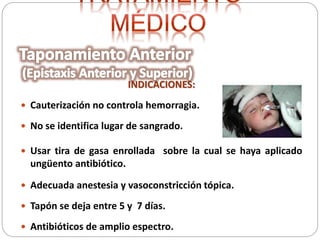 INDICACIONES:
 Cauterización no controla hemorragia.
 No se identifica lugar de sangrado.
 Usar tira de gasa enrollada sobre la cual se haya aplicado
ungüento antibiótico.
 Adecuada anestesia y vasoconstricción tópica.
 Tapón se deja entre 5 y 7 días.
 Antibióticos de amplio espectro.
 