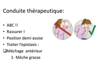 Conduite thérapeutique:
• ABC !!
• Rassurer !
• Position demi assise
• Traiter l’epistaxis :
Méchage antérieur
1- Mèche grasse
 