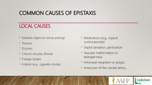 Epistaxis update management 