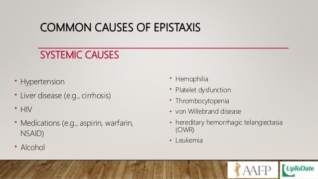 Epistaxis update management Epistaxis update management
