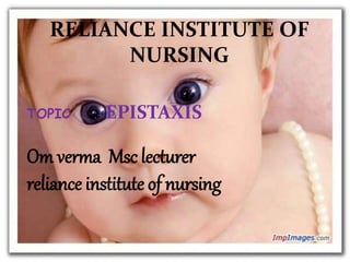 RELIANCE INSTITUTE OF
NURSING
TOPIC :- EPISTAXIS
Om verma Msc lecturer
reliance institute of nursing
 