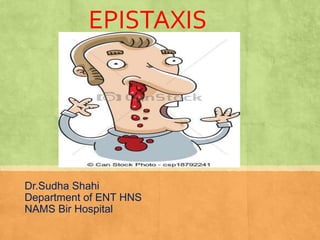 EPISTAXIS
Dr.Sudha Shahi
Department of ENT HNS
NAMS Bir Hospital
 