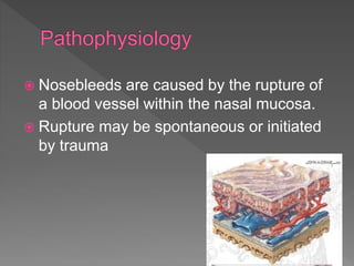  Nosebleeds are caused by the rupture of
a blood vessel within the nasal mucosa.
 Rupture may be spontaneous or initiated
by trauma
 
