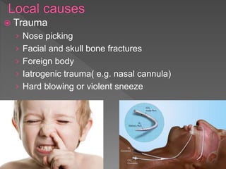  Trauma
› Nose picking
› Facial and skull bone fractures
› Foreign body
› Iatrogenic trauma( e.g. nasal cannula)
› Hard blowing or violent sneeze
 