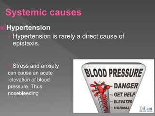  Hypertension
› Hypertension is rarely a direct cause of
epistaxis.
› Stress and anxiety
can cause an acute
elevation of blood
pressure. Thus
nosebleeding
 