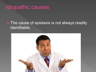  The cause of epistaxis is not always readily
identifiable.
 