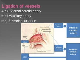  a) External carotid artery
 b) Maxillary artery
 c) Ethmoidal arteries
 