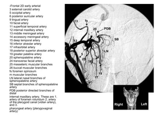-Frontal 2D early arterial
3 external carotid artery
5 occipital artery
6 posterior auricular artery
9 lingual artery
10 facial artery
11 superficial temporal artery
12 internal maxillary artery
13 middle meningeal artery
14 accessory meningeal artery
15 deep temporal artery
16 inferior alveolar artery
17 infraorbital artery
18 posterior superior alveolar artery
19 greater palatine artery
20 sphenopalatine artery
24 transverse facial artery
25 masseteric muscular branches
26 buccal muscular branches
fs foramen spinosum
m muscular branches
LN lateral nasal branches of
sphenopalatine artery
SB septal branches of sphenopalatine
artery
PDB posterior directed branches of
distal
internal maxillary artery. These are 1.
artery of foramen rotundum 2. artery
of the pterygoid canal (vidian artery),
and 3.
pharyngeal artery (pterygovaginal
artery)
 
