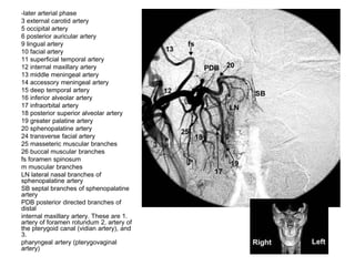 -later arterial phase
3 external carotid artery
5 occipital artery
6 posterior auricular artery
9 lingual artery
10 facial artery
11 superficial temporal artery
12 internal maxillary artery
13 middle meningeal artery
14 accessory meningeal artery
15 deep temporal artery
16 inferior alveolar artery
17 infraorbital artery
18 posterior superior alveolar artery
19 greater palatine artery
20 sphenopalatine artery
24 transverse facial artery
25 masseteric muscular branches
26 buccal muscular branches
fs foramen spinosum
m muscular branches
LN lateral nasal branches of
sphenopalatine artery
SB septal branches of sphenopalatine
artery
PDB posterior directed branches of
distal
internal maxillary artery. These are 1.
artery of foramen rotundum 2. artery of
the pterygoid canal (vidian artery), and
3.
pharyngeal artery (pterygovaginal
artery)
 