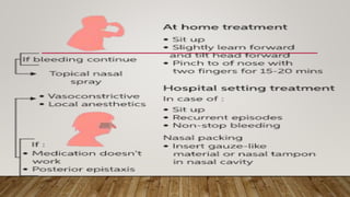 Epistaxis.pptx
