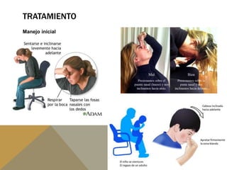 TRATAMIENTO
Manejo inicial
 