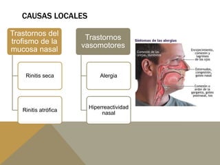 CAUSAS LOCALES
Trastornos del
trofismo de la
mucosa nasal
Rinitis seca
Rinitis atrófica
Trastornos
vasomotores
Alergia
Hiperreactividad
nasal
 