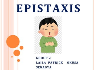 EPISTAXIS
GROUP 2
LAILA PATRICK OKUSA
SEKAGYA
 