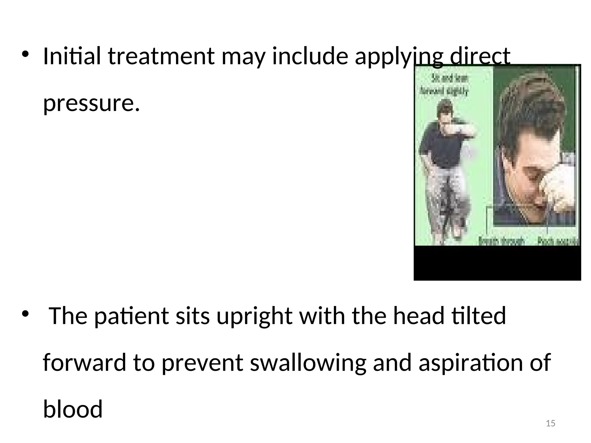 • Initial treatment may include applying direct
pressure.
• The patient sits upright with the head tilted
forward to prevent swallowing and aspiration of
blood 15
 