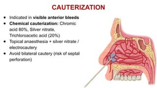 EPISTAXIS: Etiology, Classification, Differential Diagnoses, Management ...