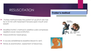 EPISTAXIS[1] ABI.pptx. Very imp topic of ENT | PPTX