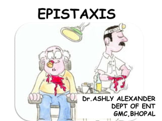 EPISTAXIS
Dr.ASHLY ALEXANDER
DEPT OF ENT
GMC,BHOPAL
 