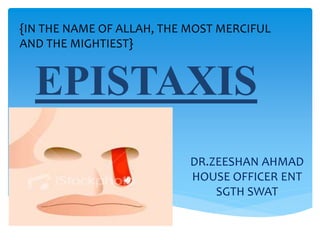 EPISTAXIS
DR.ZEESHAN AHMAD
HOUSE OFFICER ENT
SGTH SWAT
{IN THE NAME OF ALLAH, THE MOST MERCIFUL
AND THE MIGHTIEST}
 