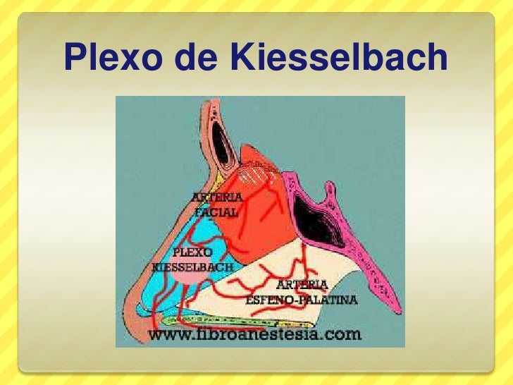 Epistaxis