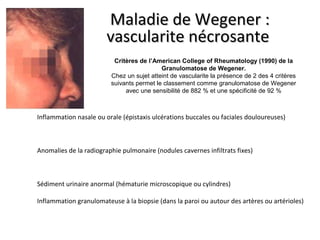 Inflammation nasale ou orale (épistaxis ulcérations buccales ou faciales douloureuses)
Anomalies de la radiographie pulmonaire (nodules cavernes infiltrats fixes)
Sédiment urinaire anormal (hématurie microscopique ou cylindres)
Inflammation granulomateuse à la biopsie (dans la paroi ou autour des artères ou artérioles)
Critères de l’American College of Rheumatology (1990) de la
Granulomatose de Wegener.
Chez un sujet atteint de vascularite la présence de 2 des 4 critères
suivants permet le classement comme granulomatose de Wegener
avec une sensibilité de 882 % et une spécificité de 92 %
Maladie de Wegener :Maladie de Wegener :
vascularite nécrosantevascularite nécrosante
 