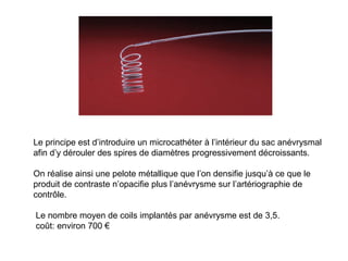 Le principe est d’introduire un microcathéter à l’intérieur du sac anévrysmal
afin d’y dérouler des spires de diamètres progressivement décroissants.
On réalise ainsi une pelote métallique que l’on densifie jusqu’à ce que le
produit de contraste n’opacifie plus l’anévrysme sur l’artériographie de
contrôle.
Le nombre moyen de coils implantés par anévrysme est de 3,5.
coût: environ 700 €
 