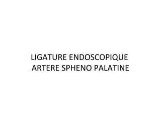 LIGATURE ENDOSCOPIQUE
ARTERE SPHENO PALATINE
 