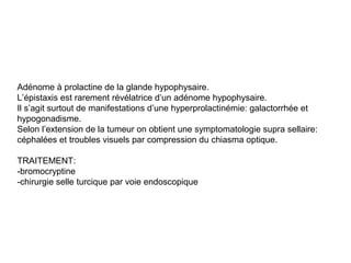 Adénome à prolactine de la glande hypophysaire.
L’épistaxis est rarement révélatrice d’un adénome hypophysaire.
Il s’agit surtout de manifestations d’une hyperprolactinémie: galactorrhée et
hypogonadisme.
Selon l’extension de la tumeur on obtient une symptomatologie supra sellaire:
céphalées et troubles visuels par compression du chiasma optique.
TRAITEMENT:
-bromocryptine
-chirurgie selle turcique par voie endoscopique
 