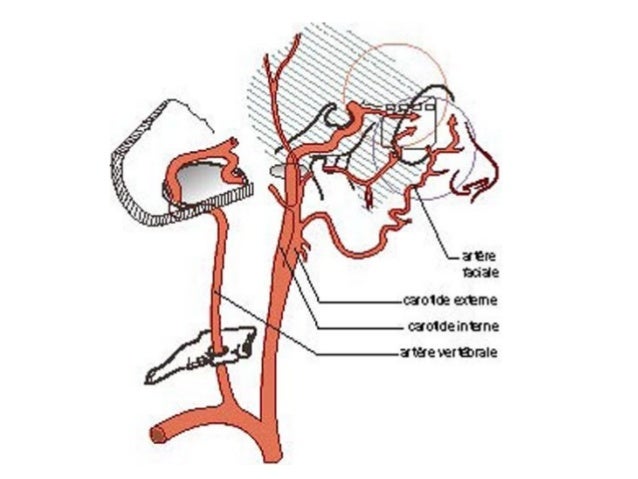 Epistaxis conference