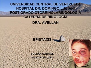 UNIVERSIDAD CENTRAL DE VENEZUELAHOSPITAL DR. DOMINGO LUCIANIPOST GRADO OTORRINOLARINGOLOGÍACATEDRA DE RINOLOGÍADRA. AVELLAN EPISTAXIS VOLCÁN GABRIEL MARZO DEL 2007 
