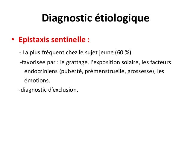 Epistaxis mh