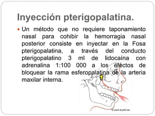 Inyección pterigopalatina. 
 Un método que no requiere taponamiento 
nasal para cohibir la hemorragia nasal 
posterior consiste en inyectar en la Fosa 
pterigopalatina, a través del conducto 
pterigopalatino 3 ml de lidocaína con 
adrenalina 1:100 000 a los efectos de 
bloquear la rama esferopalatina de la arteria 
maxilar interna. 
 