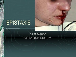EPISTAXIS
DR. M. FAROOQ
S/R ENT DEPTT. SZH RYK
 