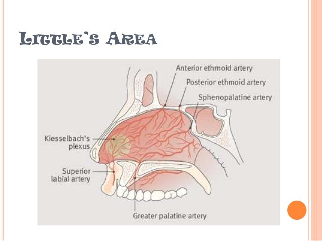 Epistaxis management