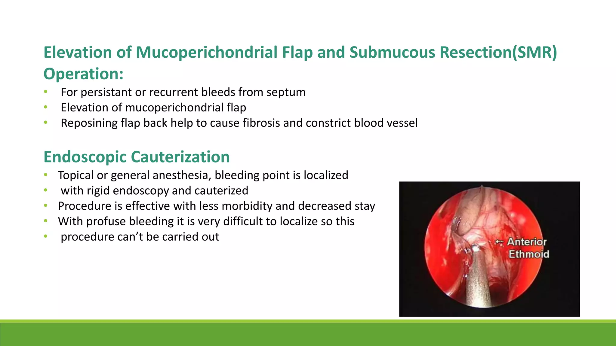 Elevation of Mucoperichondrial Flap and Submucous Resection(SMR)
Operation:
• For persistant or recurrent bleeds from septum
• Elevation of mucoperichondrial flap
• Reposining flap back help to cause fibrosis and constrict blood vessel
Endoscopic Cauterization
• Topical or general anesthesia, bleeding point is localized
• with rigid endoscopy and cauterized
• Procedure is effective with less morbidity and decreased stay
• With profuse bleeding it is very difficult to localize so this
• procedure can’t be carried out
 