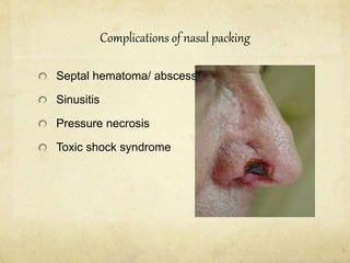 Complications of nasal packing
Septal hematoma/ abscess
Sinusitis
Pressure necrosis
Toxic shock syndrome
 