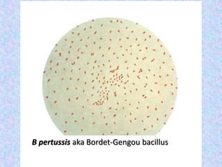 B pertussis aka Bordet-Gengou bacillus
 