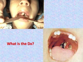 What is the Dx?
 