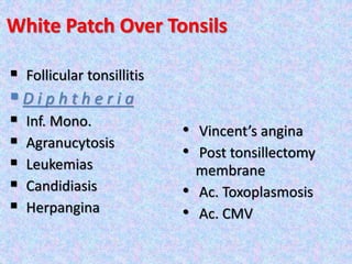 White Patch Over Tonsils
 Follicular tonsillitis
 D i p h t h e r i a
 Inf. Mono.
 Agranucytosis
 Leukemias
 Candidiasis
 Herpangina
• Vincent’s angina
• Post tonsillectomy
membrane
• Ac. Toxoplasmosis
• Ac. CMV
 