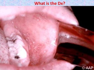 What is the Dx?
 