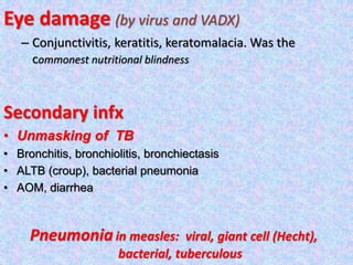 Eye damage (by virus and VADX)
– Conjunctivitis, keratitis, keratomalacia. Was the
commonest nutritional blindness
Secondary infx
• Unmasking of TB
• Bronchitis, bronchiolitis, bronchiectasis
• ALTB (croup), bacterial pneumonia
• AOM, diarrhea
Pneumoniain measles: viral, giant cell (Hecht),
bacterial, tuberculous
 