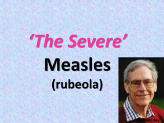 ‘The Severe’
Measles
(rubeola)
David Morley
 