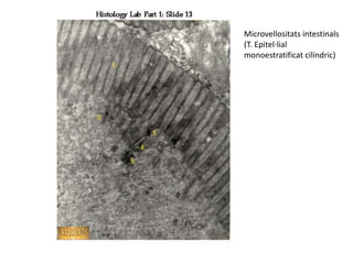 Microvellositats intestinals
(T. Epitel·lial
monoestratificat cilíndric)
 
